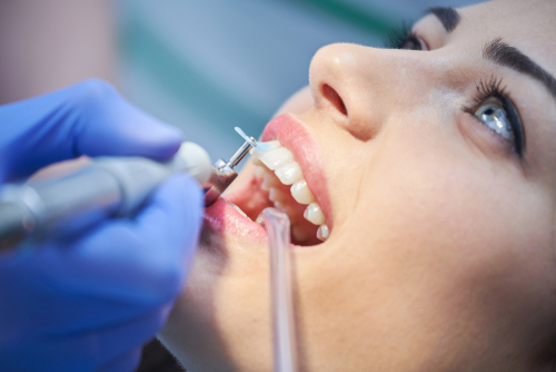 A patient undergoing their dental cleaning at The Tooth Co in Irvine, CA