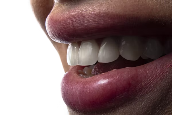 close-up shot of a woman's teeth and lips